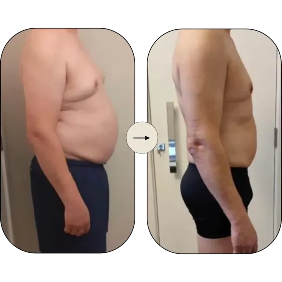 Resultado de emagrecimento 6